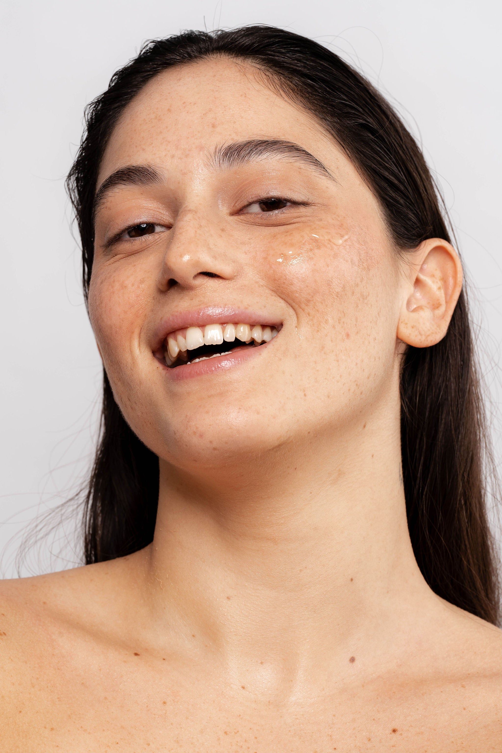 הגנת העור מפני קרינה